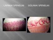 Liežuvis. Prisitatymas 15 puslapis