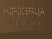 Hidrocefalija
