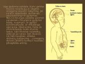 Hidrocefalija 5 puslapis