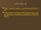 Hidrocefalija 7 puslapis