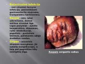 Užkečiamos ir neužkrečiamos ligos 8 puslapis