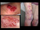 Radiacijos poveikis žmogui 7 puslapis