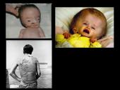 Radiacijos poveikis žmogui 10 puslapis