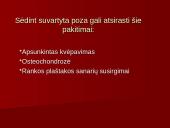 Technikos žala organizmui 11 puslapis