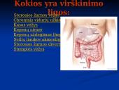 Virškinimo ligos skaidrės 4 puslapis