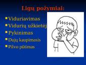 Virškinimo ligos skaidrės 5 puslapis