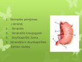 Virškinimas skaidrės 8 puslapis