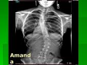 Skoliozė (S) formos 5 puslapis