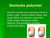 Skoliozė (S) formos 6 puslapis