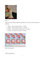 Kompresija, dekompresija. Praktinis pritaikymas reabilitacijoje 7 puslapis