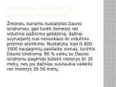 Dauno sindromas skaidrės 3 puslapis