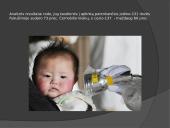 Radiacijos poveikis 17 puslapis