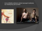 Radiacijos poveikis 8 puslapis