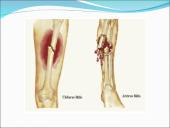 Judėjimo sistemos sutrikimai 11 puslapis