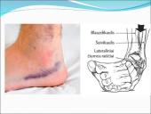 Judėjimo sistemos sutrikimai 17 puslapis