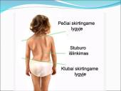 Judėjimo sistemos sutrikimai 7 puslapis