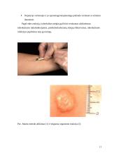 Darbas apie tuberkuliozę, jos sukėlėją, kliniką, diagnostiką 11 puslapis