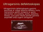 Garsas skaidrės 11 puslapis