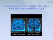 Alkoholio žala skaidrės 4 puslapis