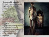 Bulimijos pristatymas ir ką sukelia per daug sveikas maitinimasis 9 puslapis