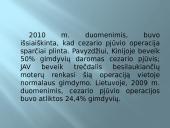 Gimdymas ir naujagimis 15 puslapis