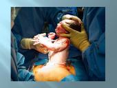 Gimdymas ir naujagimis 16 puslapis