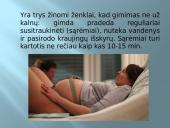 Gimdymas ir naujagimis 3 puslapis