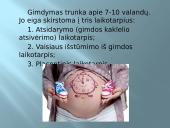 Gimdymas ir naujagimis 4 puslapis