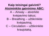 Sergančių ūmiomis ligomis požymiai ir pirmoji pagalba 7 puslapis