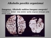 Tiesa apie alkoholį 3 puslapis