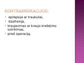 Nakvišų aliejus 11 puslapis