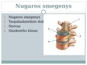Nervu sistema skaidrės 10 puslapis