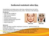 Odos tipo nustatymai, rekomendacijos ir sunkumai nustatant 3 puslapis