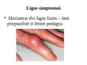 Ligos podagros pristatymas 12 puslapis