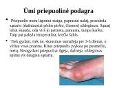 Ligos podagros pristatymas 13 puslapis