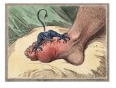 Ligos podagros pristatymas 3 puslapis