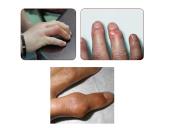 Ligos podagros pristatymas 6 puslapis