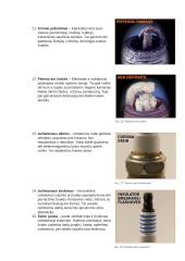 Automobilių uždegimo žvakės 14 puslapis