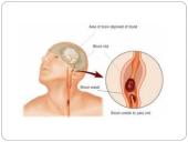 Insulto pristatymas 4 puslapis