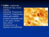 Bakterinės ligos 15 puslapis