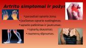 Artritas skaidrės 4 puslapis