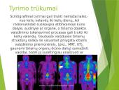 Gama kamera 15 puslapis