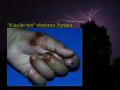 Elektros poveikis ir žala žmogaus organizmui 14 puslapis