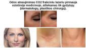 Lazerininė medicina 8 puslapis