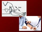 Kraujo tekėjimas kraujagyslėmis 13 puslapis