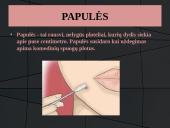 Odos bėrimai paauglystėje 11 puslapis