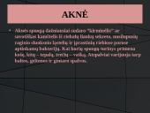 Odos bėrimai paauglystėje 13 puslapis