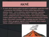 Odos bėrimai paauglystėje 14 puslapis