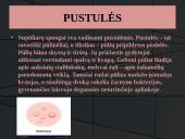 Odos bėrimai paauglystėje 10 puslapis
