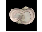 Kelio sąnario biomechanika  14 puslapis